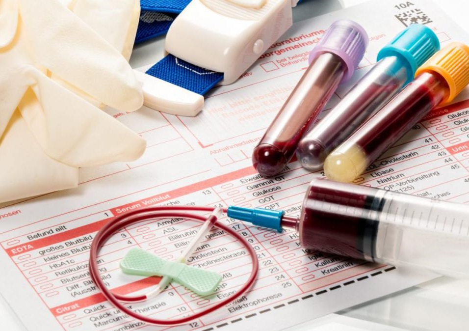 Общий анализ крови: показатели, нормы, подготовка