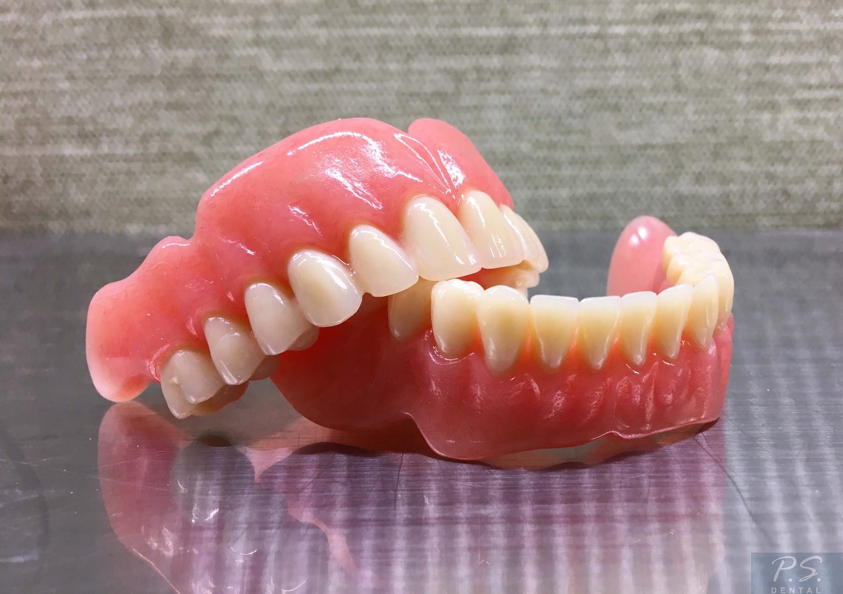 Полносъемные протезы ортопедическая стоматология